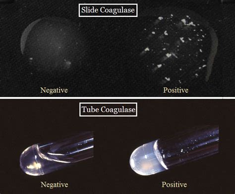 coagulase test results|1.24: Coagulase Test .